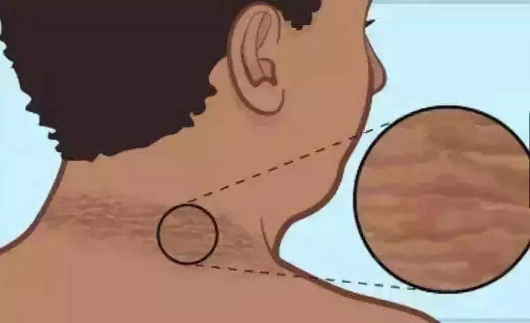 \