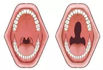 \