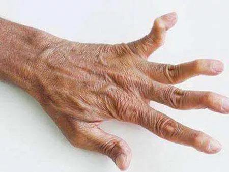 \