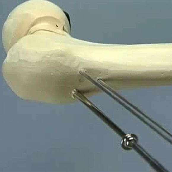 \