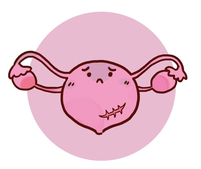 \