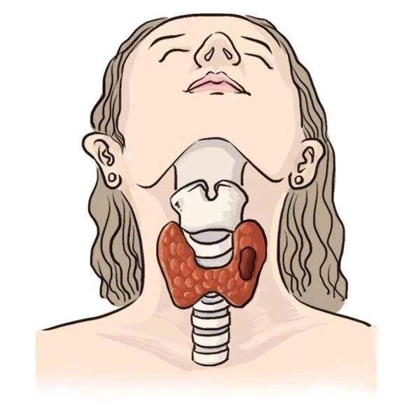 \