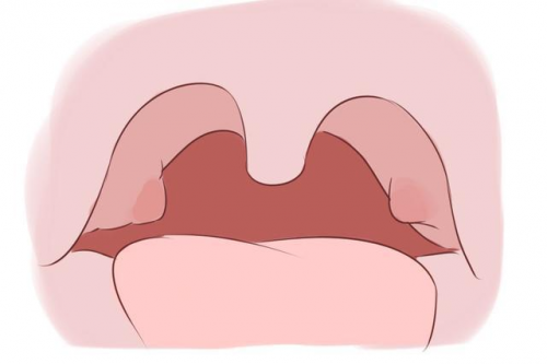 \
