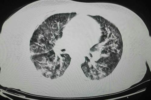 \