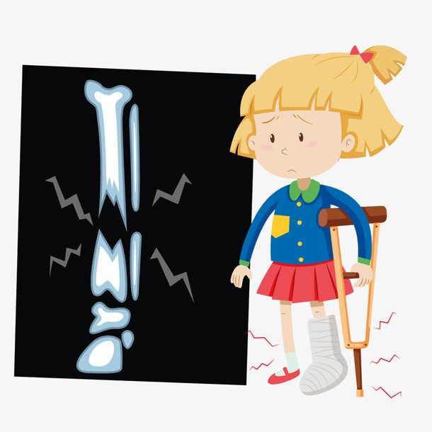 \