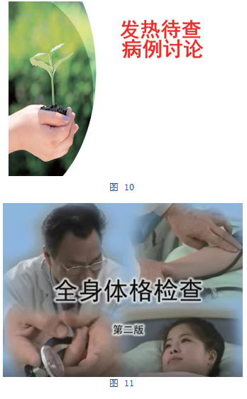 \