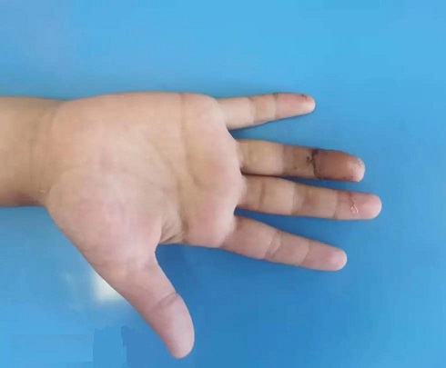 \