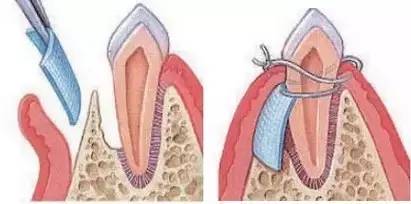 \