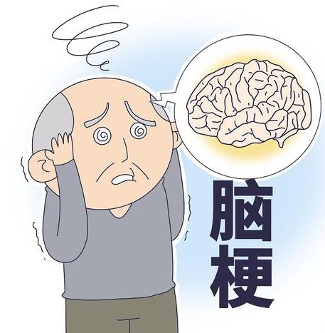 占位性恶性大脑中动脉梗死治疗的研究进展论文