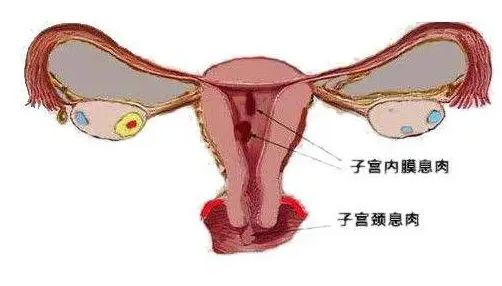 \