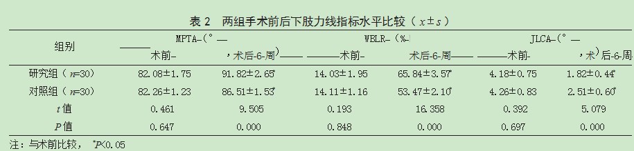 3D打印个体化截骨导板辅助胫骨高位截骨术治疗膝骨关节炎患者的效果论文
