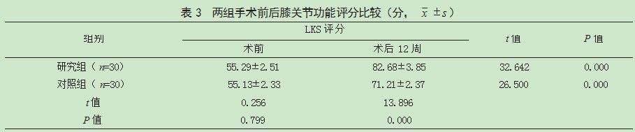 3D打印个体化截骨导板辅助胫骨高位截骨术治疗膝骨关节炎患者的效果论文