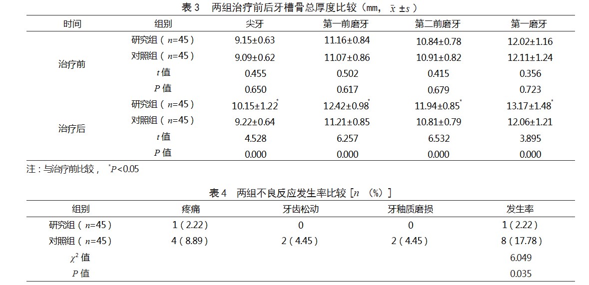 牙周辅助加速成骨正畸治疗错牙合畸形患者的效果论文