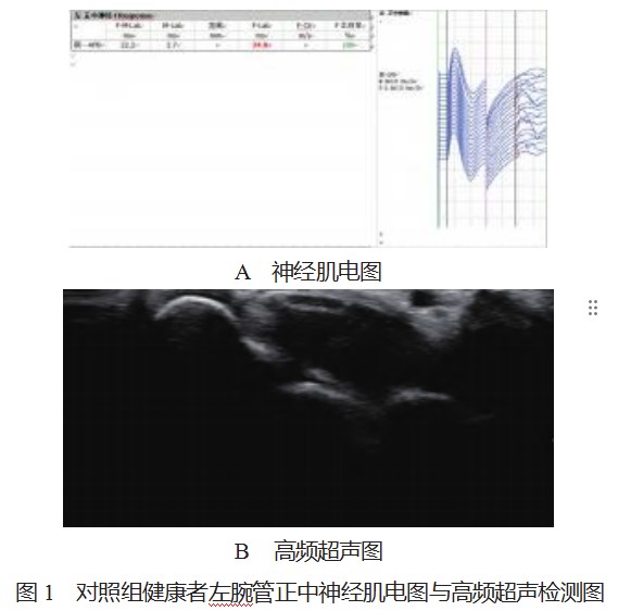 不同程度腕管综合征患者应用高频超声与神经肌电图检查的诊断价值对比论文