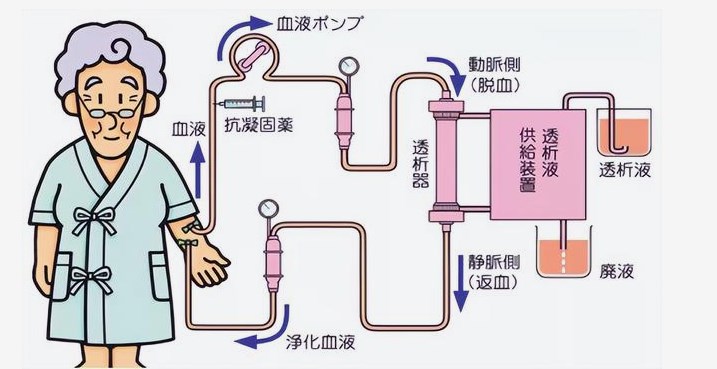 血液透析患者希望水平影响因素和干预措施研究进展论文