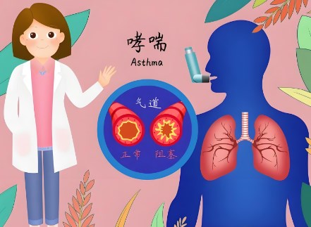 咳嗽变异性哮喘患者的联合用药治疗研究进展论文