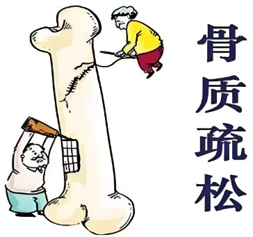 绝经后骨质疏松患者药物干预依从性影响因素分析论文